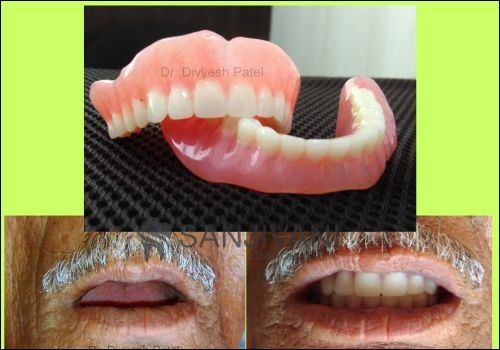 A Fresh Path to Confident Smiles in Rajkot