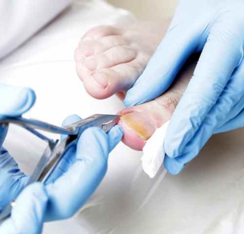 Clear paths to healthier nails with targeted care