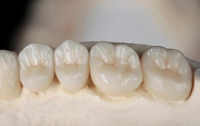 Where Craft and Care Converge in a Local Dental Lab